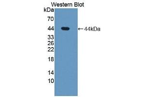 Detection of Recombinant STS, Human using Polyclonal Antibody to Steroid Sulfatase Isozyme S (STS) (STS antibody  (AA 235-583))