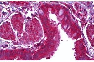 Anti-MFGE8 / MFG-E8 antibody IHC staining of human lung, epithelium. (MFGE8 antibody)
