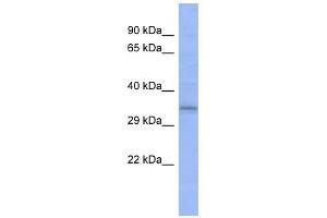 C20ORF111 antibody used at 1 ug/ml to detect target protein. (C20orf111 antibody  (N-Term))