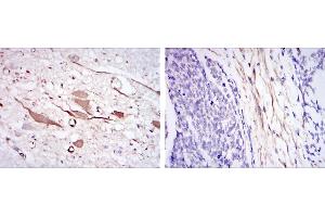 Immunohistochemical analysis of paraffin-embedded brain tissues (left) and esophageal cancer tissues (right) using HSP27 mouse mAb with DAB staining. (HSP27 antibody)