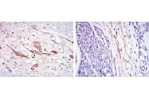 Immunohistochemical analysis of paraffin-embedded brain tissues (left) and esophageal cancer tissues (right) using HSP27 mouse mAb with DAB staining. (HSP27 antibody)