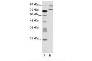 ZNF709 anticorps  (AA 61-110)