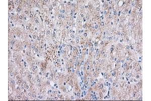 Immunohistochemical staining of paraffin-embedded Human liver tissue using anti-BTK mouse monoclonal antibody. (BTK antibody)