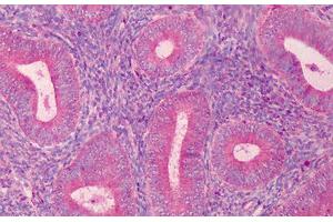 Human Endometrium: Formalin-Fixed, Paraffin-Embedded (FFPE) (PAK2 antibody  (C-Term))