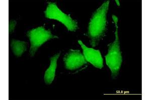 Immunofluorescence of purified MaxPab antibody to CDK5 on HeLa cell. (CDK5 antibody  (AA 1-292))