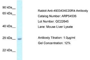 Western Blotting (WB) image for anti-RIKEN CDNA 4933434E20 Gene (4933434E20RIK) (N-Term) antibody (ABIN2774077) (4933434E20Rik antibody  (N-Term))