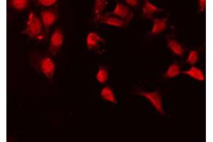 ABIN6267599 staining HeLa by IF/ICC. (NF-kB p65 antibody  (pSer468))