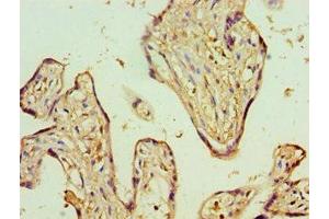 Immunohistochemistry of paraffin-embedded human placenta tissue using ABIN7143353 at dilution of 1:100 (ADSS antibody  (AA 1-280))