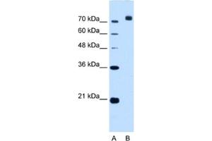 Western Blotting (WB) image for anti-Corin, Serine Peptidase (CORIN) antibody (ABIN2463005)
