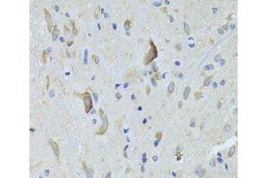 Immunohistochemistry of paraffin-embedded Rat spinal cord using SARS Polyclonal Antibody at dilution of 1:100 (40x lens). (Seryl-tRNA Synthetase (SARS) antibody)