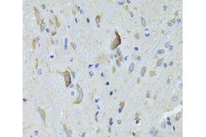 Immunohistochemistry of paraffin-embedded Rat spinal cord using SARS Polyclonal Antibody at dilution of 1:100 (40x lens). (Seryl-tRNA Synthetase (SARS) antibody)