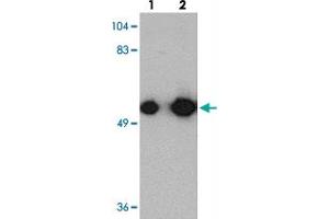 Western blot analysis of KREMEN1 in rat small intestine tissue with KREMEN1 polyclonal antibody  at (lane 1) 0. (KREMEN1 antibody  (C-Term))