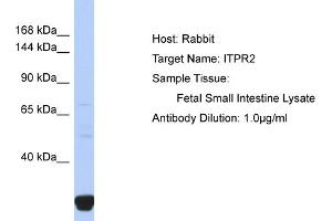 Host: Rabbit Target Name: ITPR2 Sample Type: Fetal Small Intestine lysates Antibody Dilution: 1. (ITPR2 antibody  (N-Term))