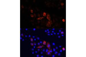 Immunofluorescence analysis of HeLa cells using MT-ND2 antibody (ABIN7268600) at dilution of 1:100. (MT-ND2 antibody  (C-Term))
