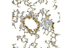 Immunohistochemistry of paraffin-embedded mouse lung using IFIH1 Rabbit pAb (ABIN6131879, ABIN6142174, ABIN6142175 and ABIN6217724) at dilution of 1:50 (40x lens). (IFIH1 antibody  (AA 1-205))