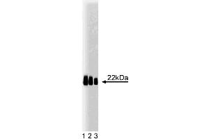 Western blot analysis of Caveolin 1. (Caveolin-1 antibody  (AA 1-178))