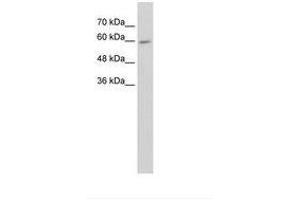 Image no. 1 for anti-Cytochrome P450, Family 4, Subfamily F, Polypeptide 11 (CYP4F11) (AA 51-100) antibody (ABIN203436) (CYP4F11 antibody  (AA 51-100))