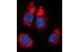 Immunofluorescent analysis of Alpha-1A Adrenergic Receptor staining in NIH3T3 cells. (alpha 1 Adrenergic Receptor antibody  (C-Term))