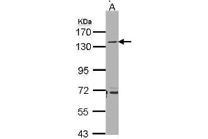 WB Image Sample(30 ug whole cell lysate) A:Raji , 7. (CD22 antibody)