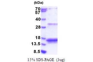 SDS-PAGE (SDS) image for Eukaryotic Translation Initiation Factor 4E Binding Protein 3 (EIF4EBP3) (AA 1-100) protein (His tag) (ABIN5853824)