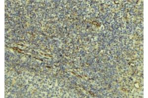 ABIN6276540 at 1/100 staining Human lymph tissue by IHC-P. (DcR1 antibody)