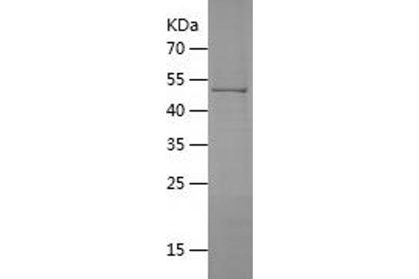 HSD17B11 Protein (AA 28-300) (His-IF2DI Tag)
