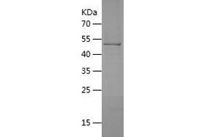 Western Blotting (WB) image for Hydroxysteroid (17-Beta) Dehydrogenase 11 (HSD17B11) (AA 28-300) protein (His-IF2DI Tag) (ABIN7123387) (HSD17B11 Protein (AA 28-300) (His-IF2DI Tag))