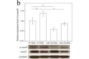 Western Blotting (WB) image for anti-Glyceraldehyde-3-Phosphate Dehydrogenase (GAPDH) antibody (ABIN2857072)