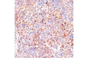 Immunohistochemistry of paraffin-embedded mouse spleen using IL4R antibody (ABIN7268001) at dilution of 1:100 (40x lens). (IL4 Receptor antibody  (AA 26-232))