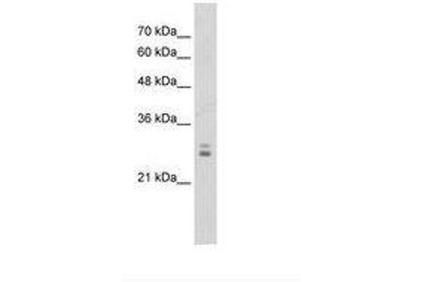 KCTD11 anticorps  (AA 41-90)