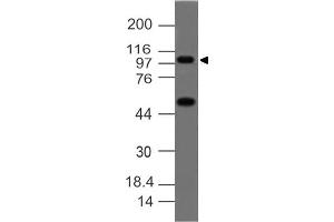 Image no. 1 for anti-Tumor Necrosis Factor, alpha-Induced Protein 3 (TNFAIP3) (C-Term) antibody (ABIN5027468) (TNFAIP3 antibody  (C-Term))