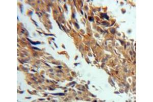 IHC-P analysis of ovary tissue, with DAB staining. (TGM3 antibody  (AA 468-693))