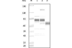 Western blot analysis using anti-KSHV ORF8 polyclonal antiobdy against uninduced BCBL1 cell lysate (1), TPA induced BCBL1 cell lysate(2) and purified virion (3). (KSHV ORF8 antibody)
