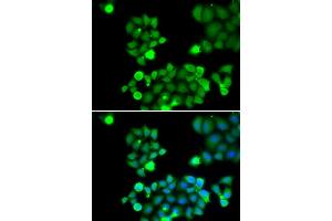 Immunofluorescence analysis of HeLa cell using NEIL1 antibody. (NEIL1 antibody)