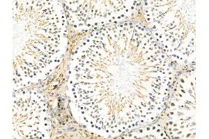 ABIN7094293 and ABIN7098340 at 1/100 staining Rat testis tissue by IHC-P.
