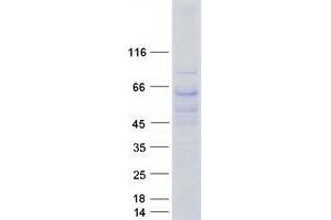 Validation with Western Blot (TBL1X Protein (Transcript Variant 1) (Myc-DYKDDDDK Tag))