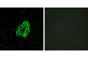 Peptide - +Immunofluorescence analysis of MCF-7 cells, using BAI1 antibody. (BAI1 antibody  (Internal Region))