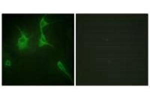 Immunofluorescence analysis of NIH/3T3 cells, using Collagen IX α3 antibody.