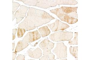 Immunohistochemistry (IHC) image for anti-Troponin I (TNNI) antibody (ABIN7795609)