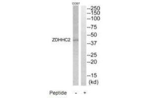 Western Blotting (WB) image for anti-Zinc Finger, DHHC-Type Containing 2 (ZDHHC2) antibody (ABIN7184357)