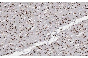 ABIN6266672 at 1/100 staining human Smooth muscle tissue sections by IHC-P. (USF2 antibody  (Internal Region))