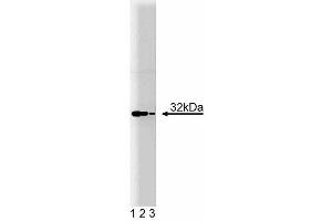 Western blot analysis of Heme Oxygenase 1 on SW13 lysate. (HMOX1 antibody  (AA 150-286))
