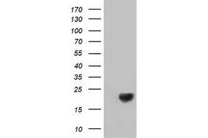 HEK293T cells were transfected with the pCMV6-ENTRY control (Left lane) or pCMV6-ENTRY DSTN (Right lane) cDNA for 48 hrs and lysed. (Destrin antibody)