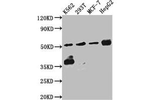 Western Blot Positive WB detected in: K562 whole cell lysate, 293T whole cell lysate, MCF-7 whole cell lysate, HepG2 whole cell lysate All lanes: Chk1 antibody at 1:1000 Secondary Goat polyclonal to rabbit IgG at 1/50000 dilution Predicted band size: 55, 44, 51 kDa Observed band size: 55 kDa (Recombinant CHEK1 antibody)