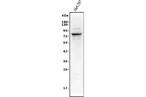 Western blot analysis of Alkaline phosphatase/ALPL using anti-Alkaline phosphatase/ALPL antibody (ABIN7603162).