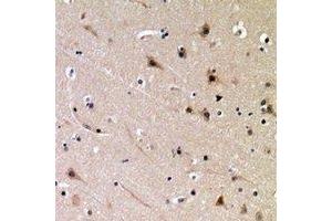 Immunohistochemical analysis of DDX3X (pT322) staining in human brain formalin fixed paraffin embedded tissue section. (DDX3X antibody  (pSer322))
