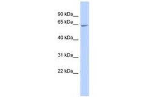 Image no. 1 for anti-UDP-N-Acetyl-alpha-D-Galactosamine:polypeptide N-Acetylgalactosaminyltransferase 18 (GALNT18) (AA 467-516) antibody (ABIN6741056) (UDP-N-Acetyl-alpha-D-Galactosamine:polypeptide N-Acetylgalactosaminyltransferase 18 (GALNT18) (AA 467-516) antibody)