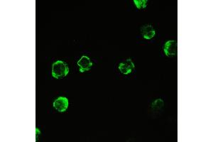IHC analysis of Cyclophilin A using anti-Cyclophilin A antibody . (PPIA antibody  (AA 116-165))