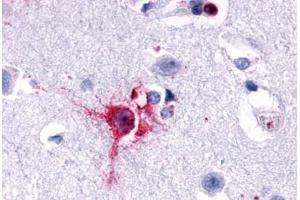 Anti-Delta Opioid Receptor antibody  ABIN1048495 IHC staining of human brain, neurons and glia. (OPRD1 antibody  (N-Term))