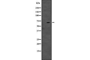 Western blot analysis of CENPT expression in ; HepG2 cell lysate,The lane on the left is treated with the antigen-specific peptide. (CENPT antibody  (Internal Region))